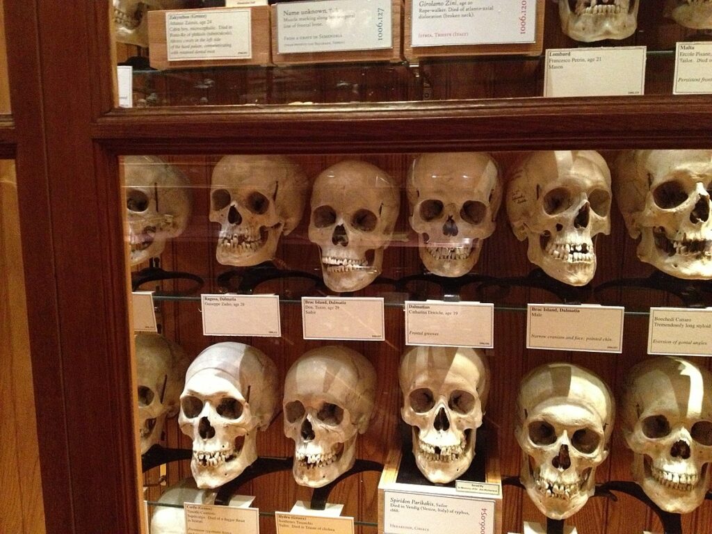 A Mütter Museum exhibit showcases a collection of human skulls